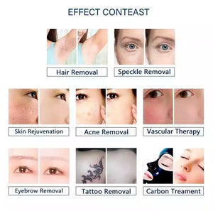 Самый горячий 4 в 1 E-light Ipl Rf Nd Yag Laser Многофункциональная машина для удаления волос